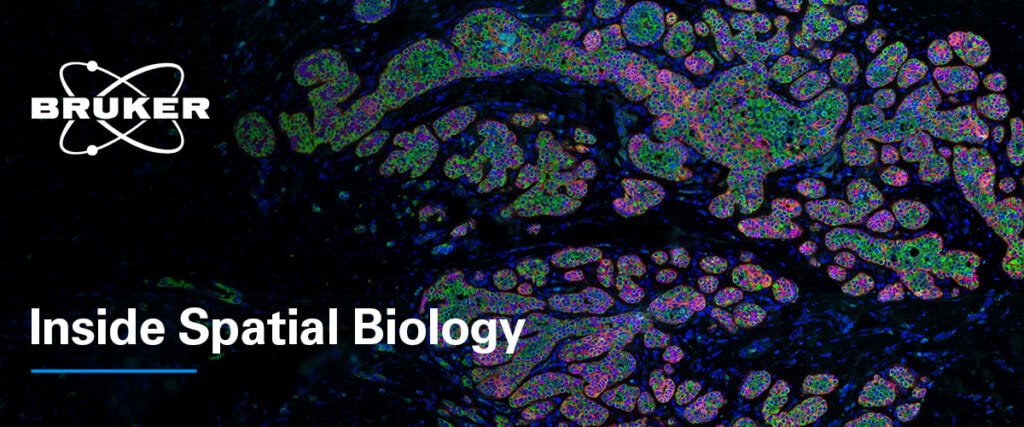 GeoMx tissue image with &ldquo;Inside Spatial Biology&rdquo; and Bruker logo overlaid.